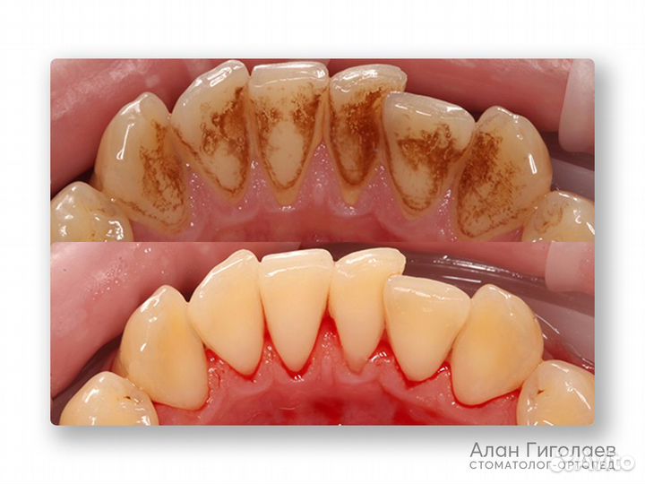 Профессиональная гигиена