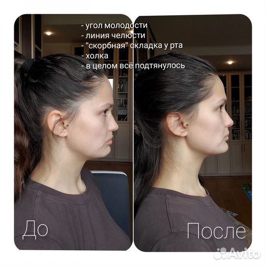 Прикладная кинезиология. Коррекция родовой травмы