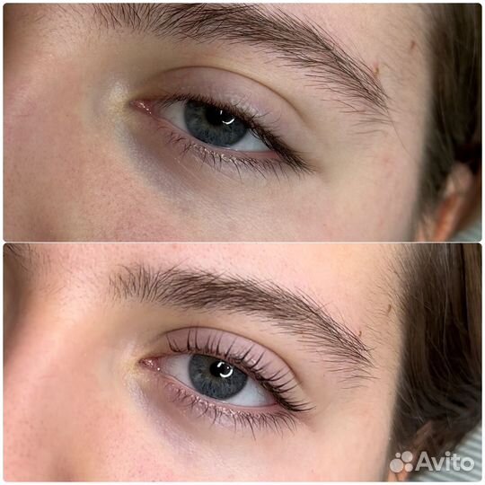 Липолитики тела, лицо