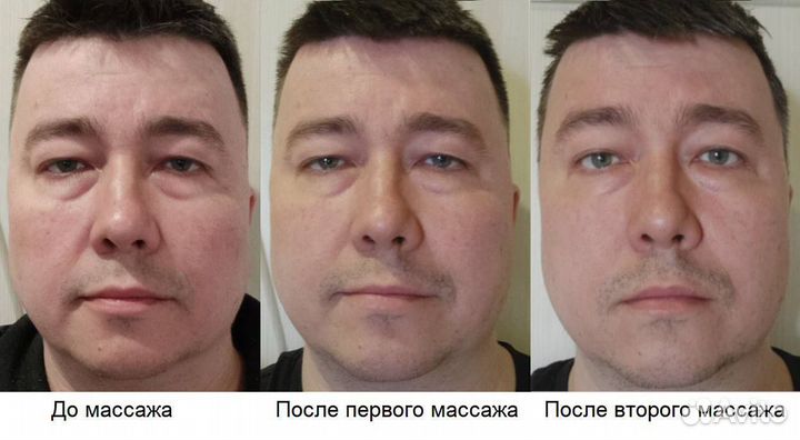 Оздоровительный Массаж