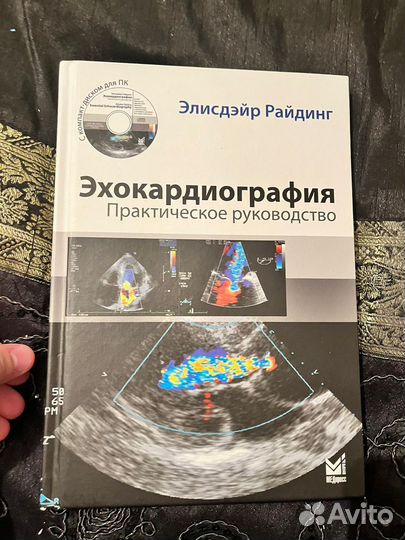 Книга эхокардиография