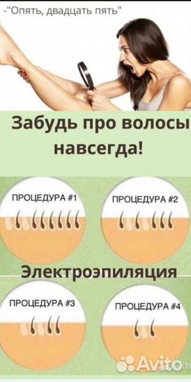 Электроэпиляция