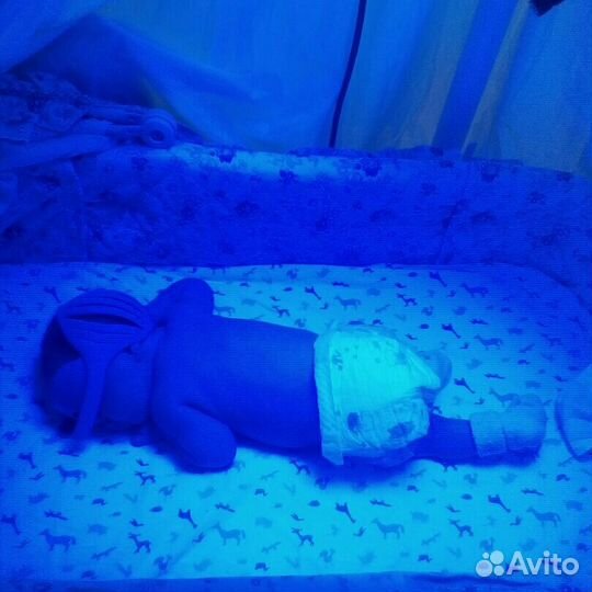 Прокат лампы от желтухи желтушки младенцев