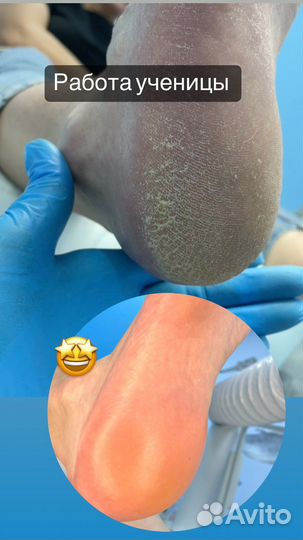 Курс по маникюру обучение по педикюру