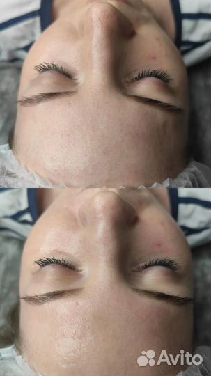 Косметолог эстетист