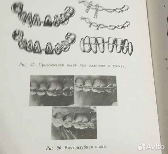 Диагностика, лечение стоматологических