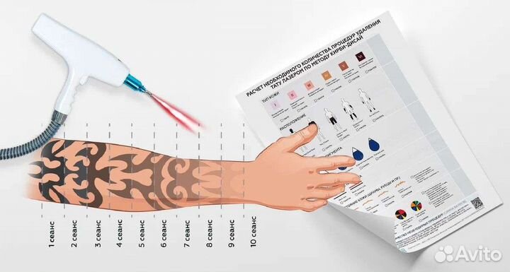 Лазерное удаление тату