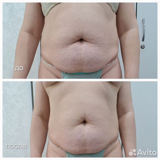 Обучение косметолог,аппаратной косметологии