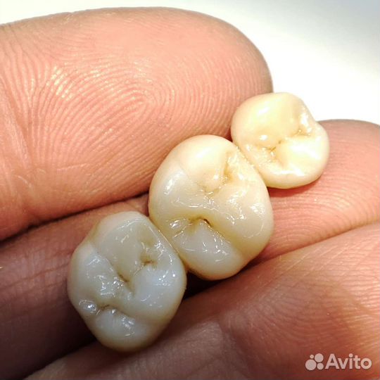 Цирконевые коронки анатомия