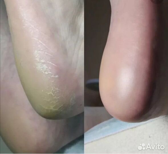 Мастер маникюра педикюра