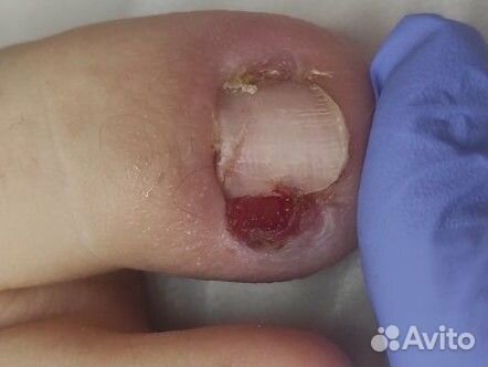 Услуги подолога