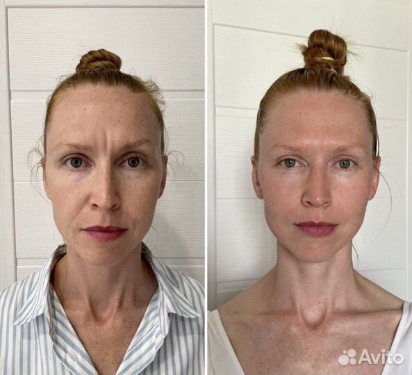 Массаж лица