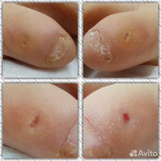 Педикюр,подолог, маникюр, наращивание