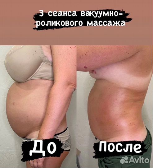 Услуги массажиста