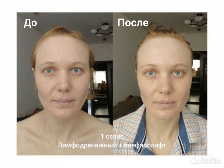 Массаж лица