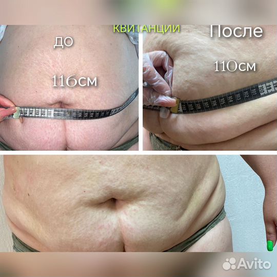 Спа процедуры