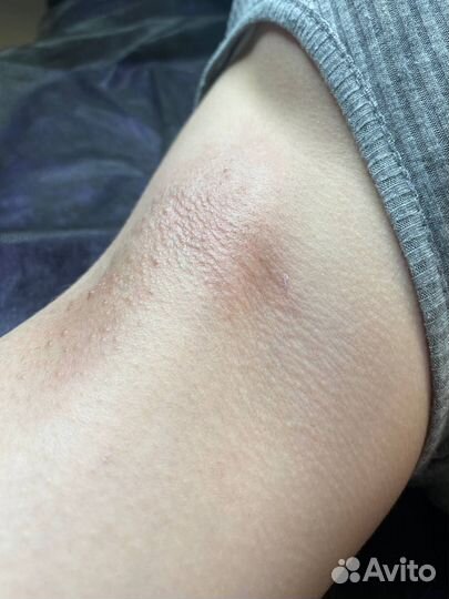 Мастер депиляции