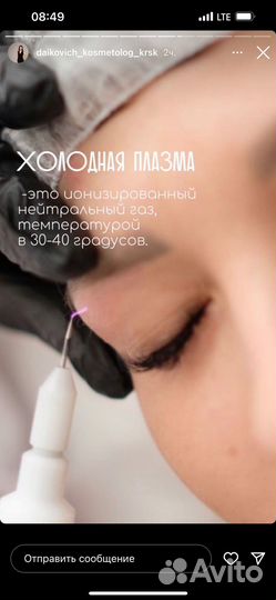 Холодная плазма, подтяжка лица, шеи и век