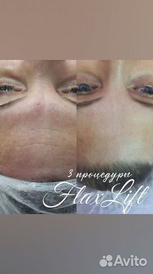 Косметик эстетист