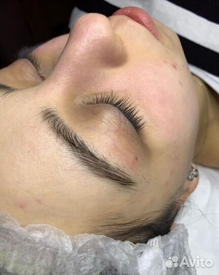 Механическая чистка лица