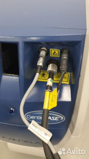 Александритовый лазер для эпиляции Candela