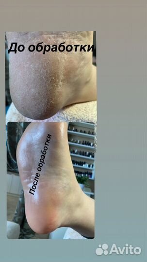 Педикюр на правом берегу