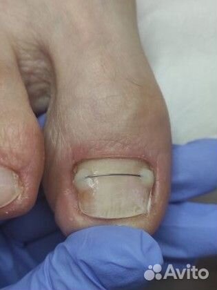 Услуги подолога