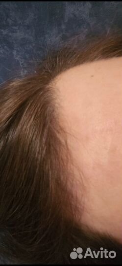 Сыворотка против выпадения волос