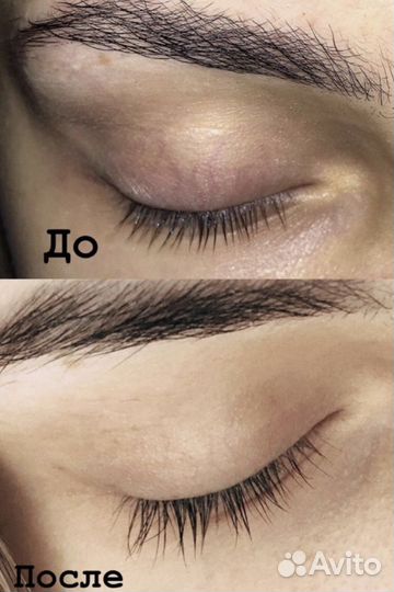 Сыворотка FEG (фег)