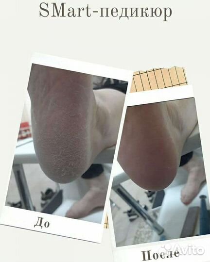 Педикюр, Маникюр