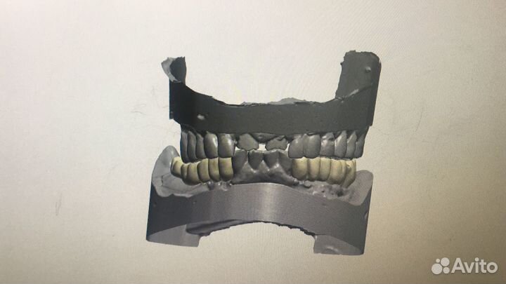 3D моделировка exocad, 3 shape