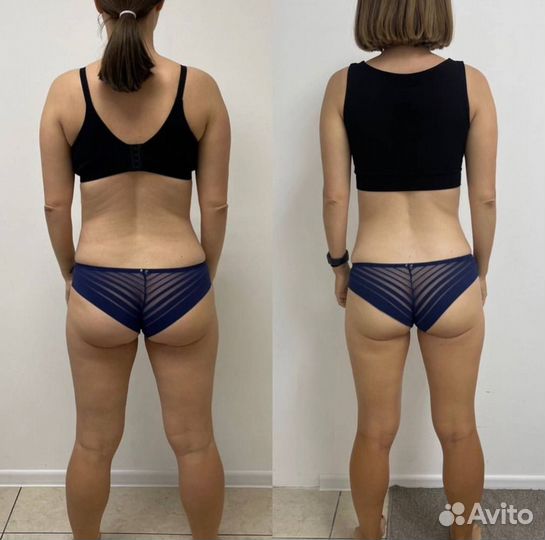 Массаж для похудения