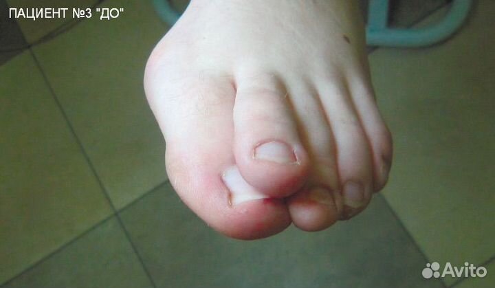 Изготовление индивидуальных отрезов