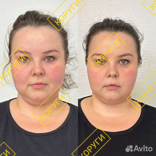 Массаж (массажист опыт более 7 лет)