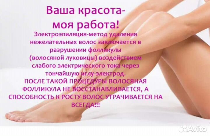 Электроэпиляция