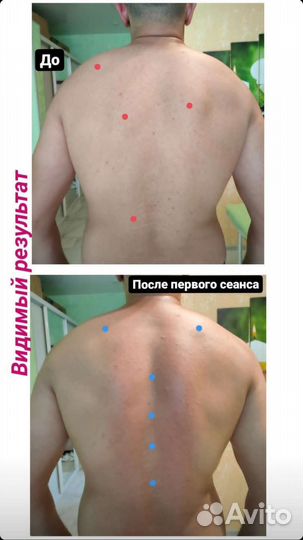 Лечебный массаж