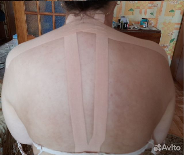 Тейпирование и фейслифтинг