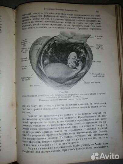 Книга 1913 г. Руководство к изучению акушерства