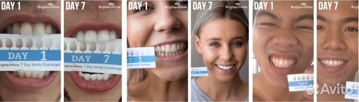 Оригинал. Система для домашнего отбеливания зубов