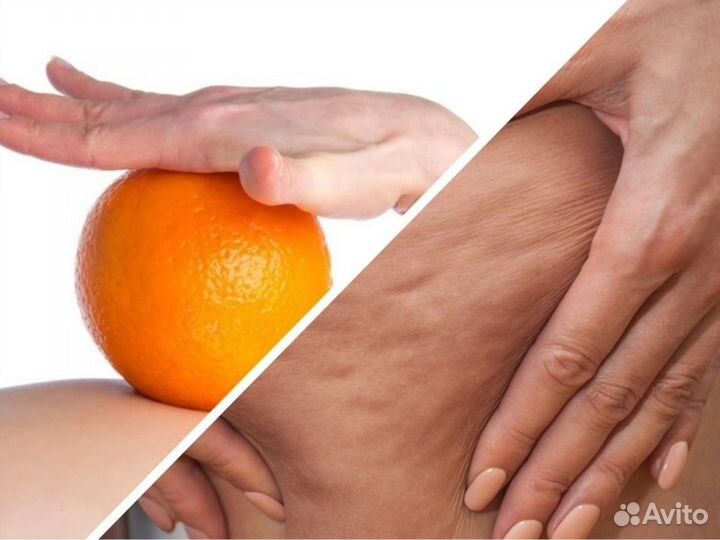 Антицеллюлитный Массаж Тела