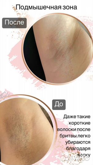 Депиляция восковая, шугаринг