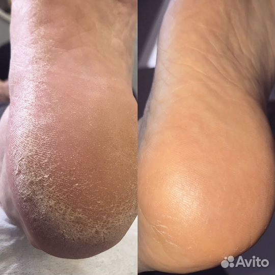 Услуги подолога