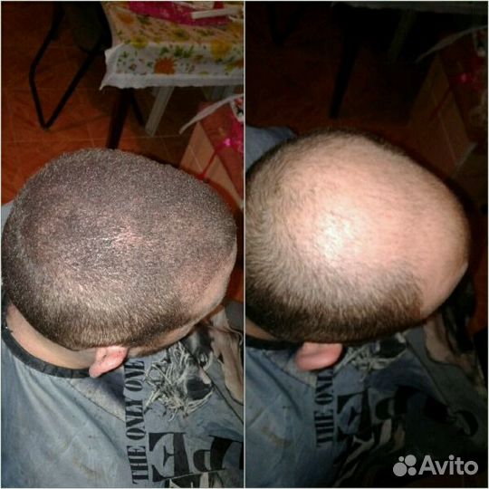 Загуститель волос