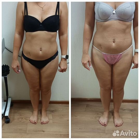 Ищу моделей на ручной антицеллюлитный масаж