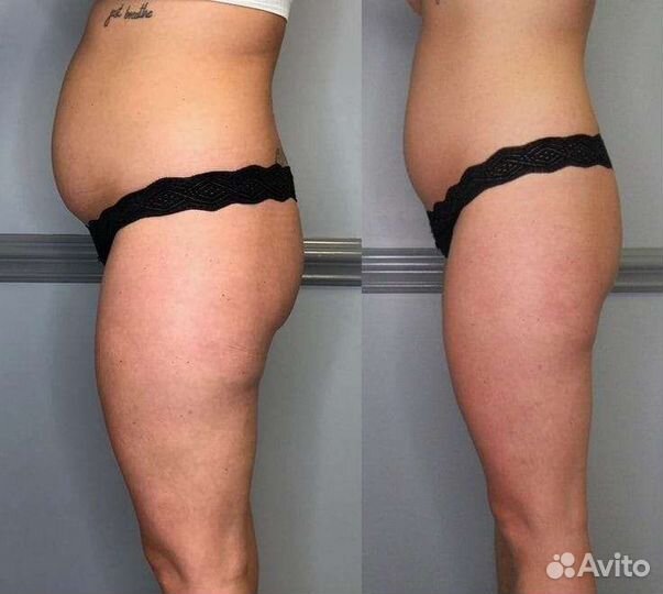 Аппаратный массаж тела и лица