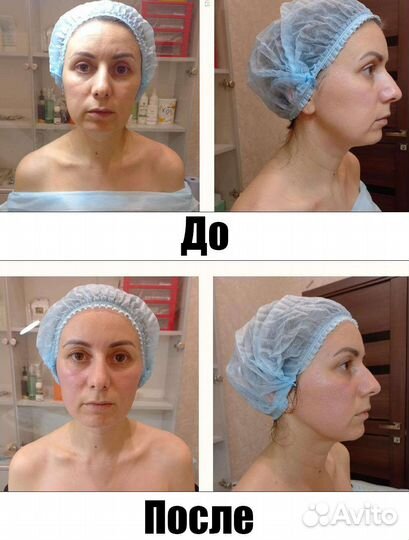 Аппаратная терапия 