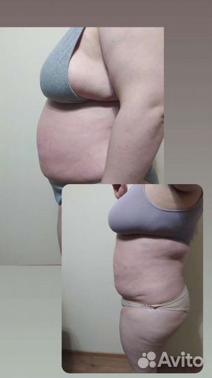 Массаж на дому