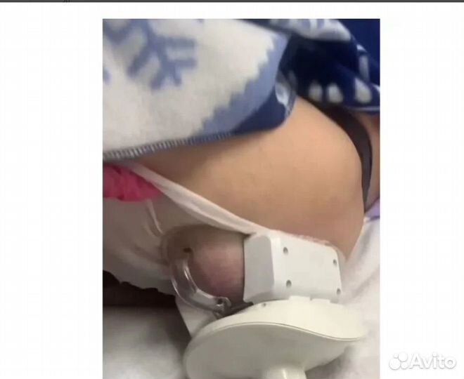 Плоский живот - размер за 1 процедуру Кирове