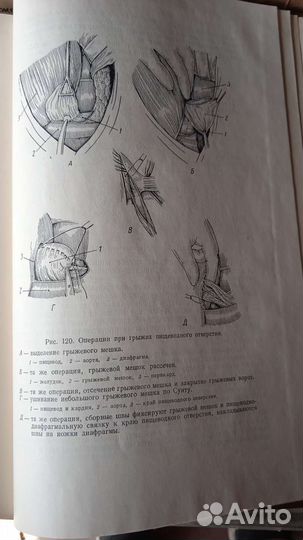 Книга Операция на органах груди