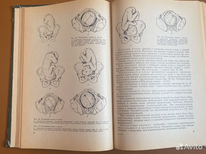 Книги СССР. Медицина. Акушерство